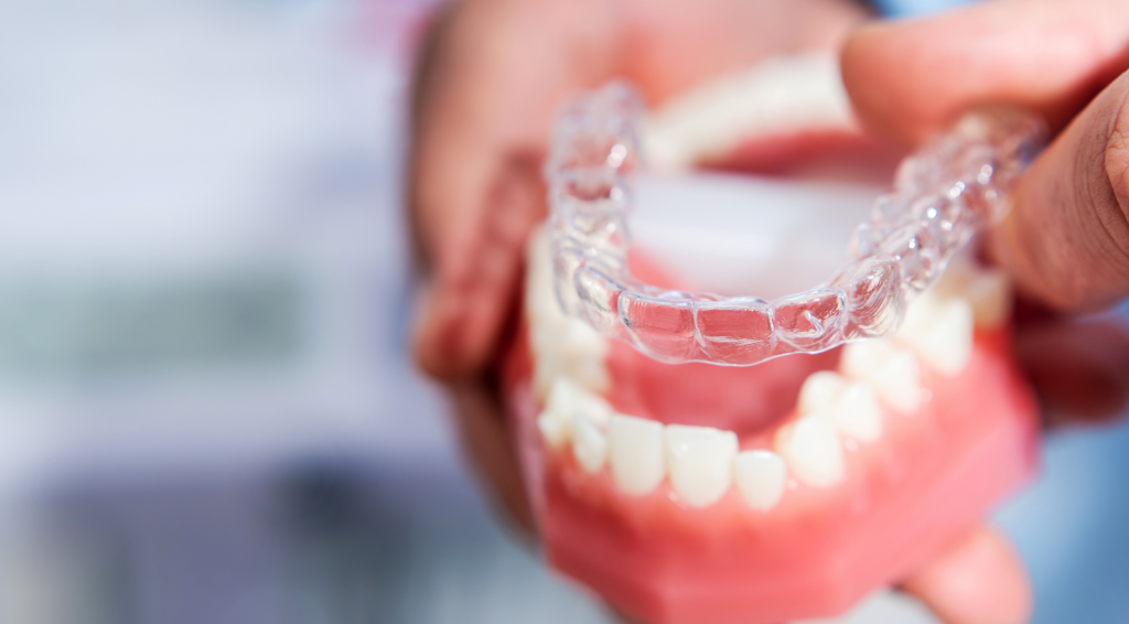 Demostración de los alineadores Invisalign