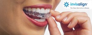 tratamiento invisalign